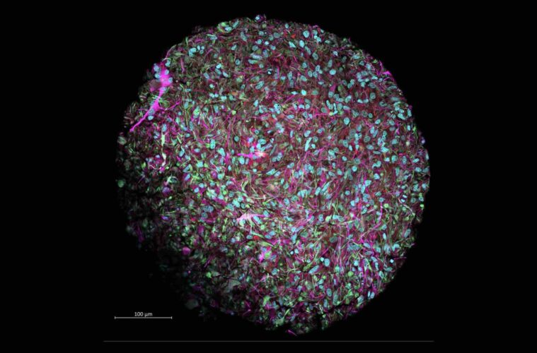 organoids