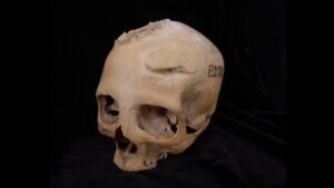 4,000-year-old Egyptian skull