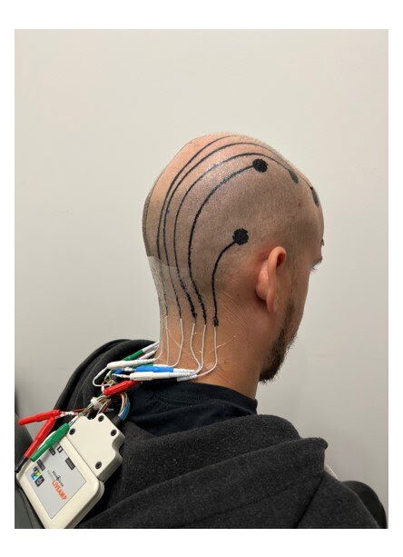 EEG setup with e-tattoo electrodes CREDIT Nanshu L