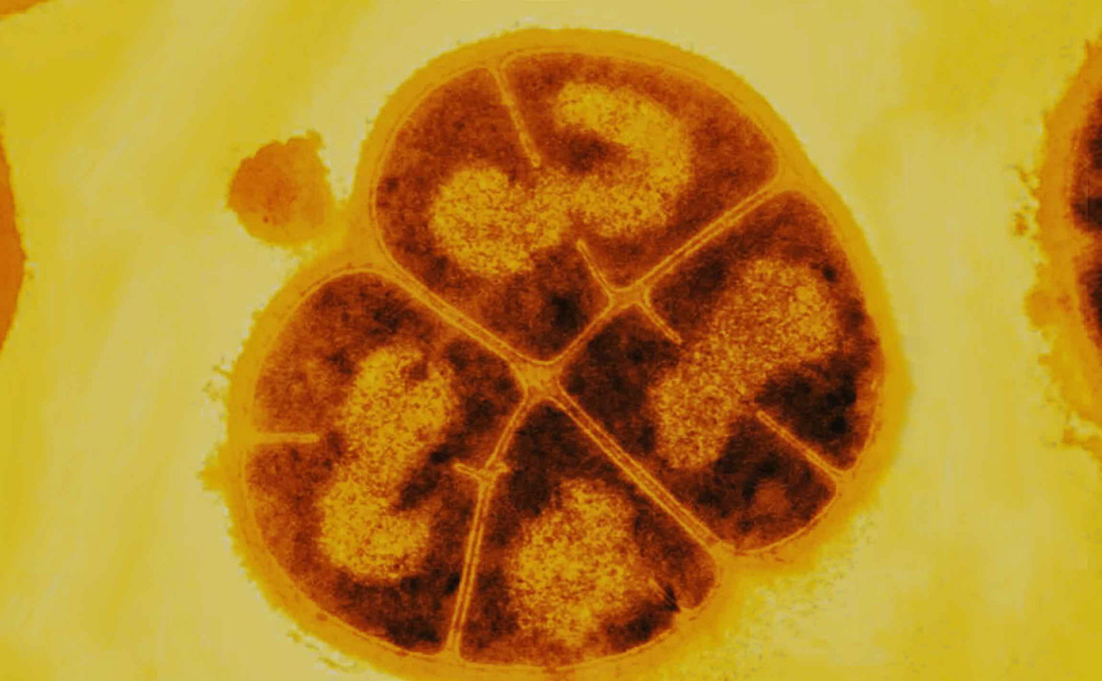 Deinococcus radiodurans